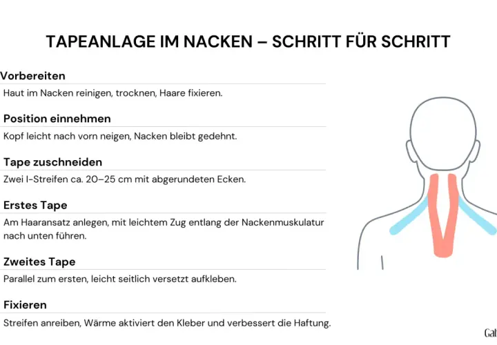 Anleitung zur Tapeanlage im Nacken: Haut vorbereiten, Position einnehmen, Tape zuschneiden und anlegen, dann fixieren.