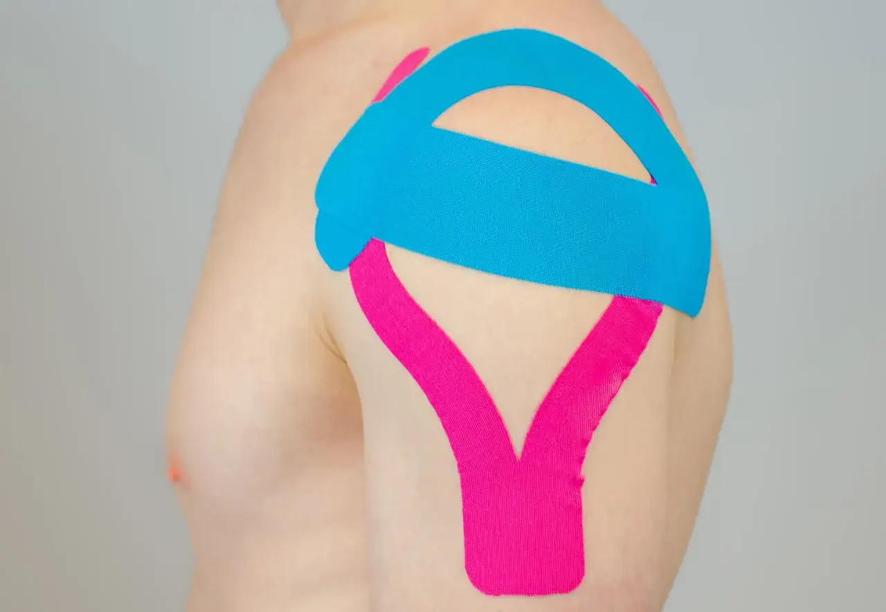 Schulter tapen mit blauem und pinkem Kinesio-Tape zur Unterst&uuml;tzung.