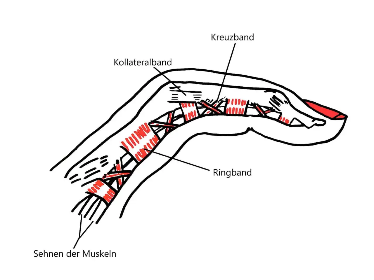 Anatomische Zeichnung eines Fingers mit Sehnen, Kollateralband, Kreuzband und Ringband. Schmerzen im Ringband des Fingers k&ouml;nnen die Beweglichkeit einschr&auml;nken.